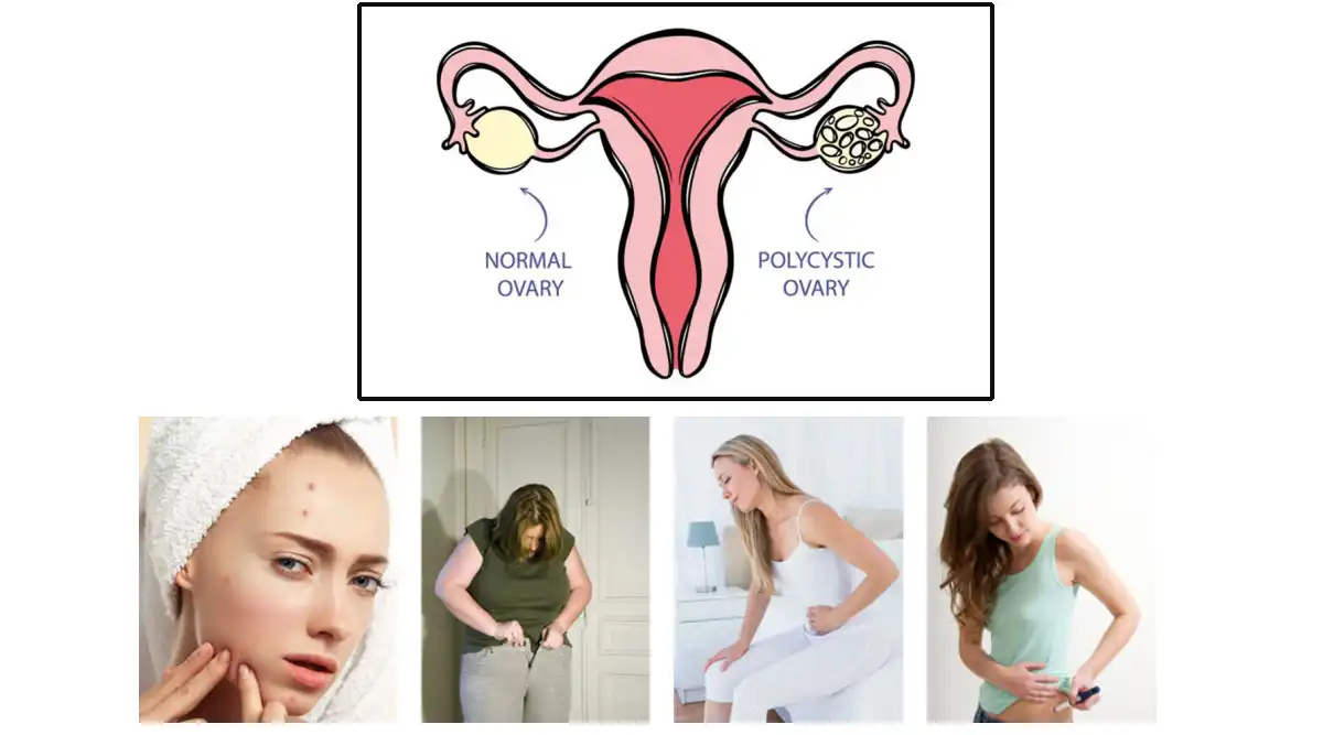 D-chiro inositol powder supplier Yangge Biotech D-chiro inositol powder supplier Yangge Biotech