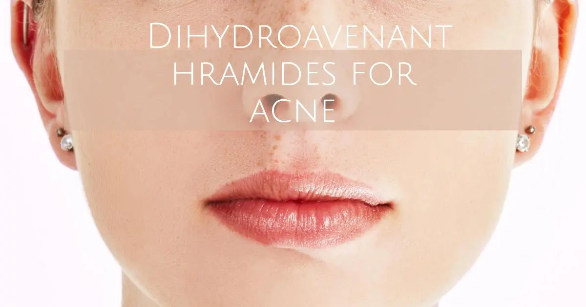 hydroxyphenyl-propamidobenzoic-acid-for-acne